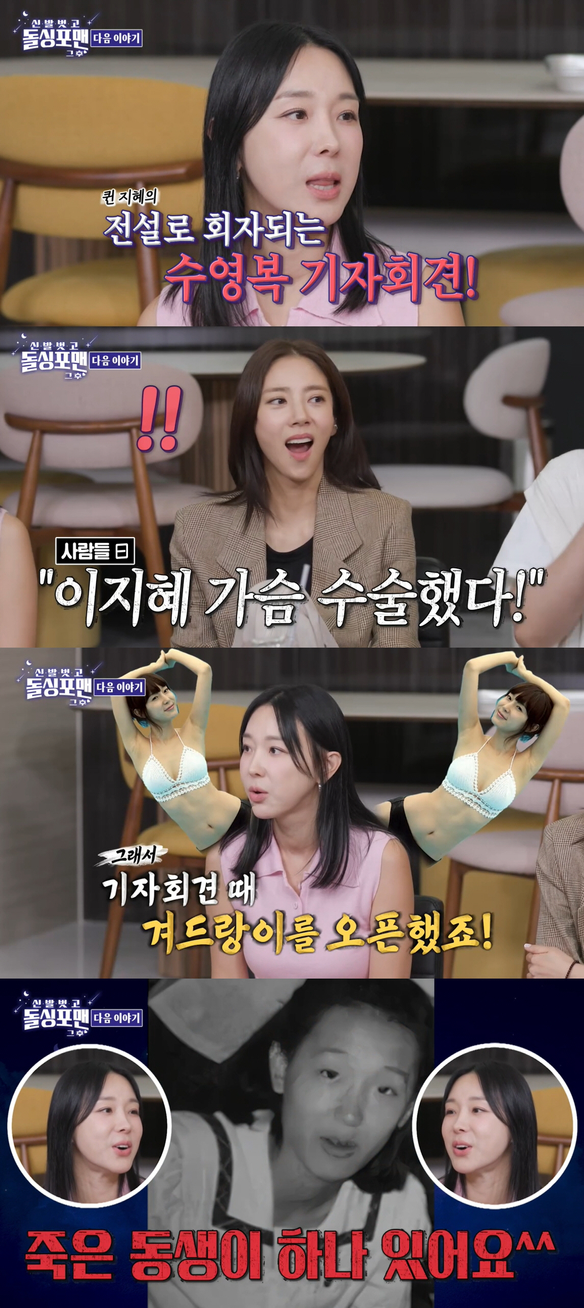 이지혜, 성형 전 사진 폭로...못 알아보게 다른 얼굴에 "죽은 동생 하…