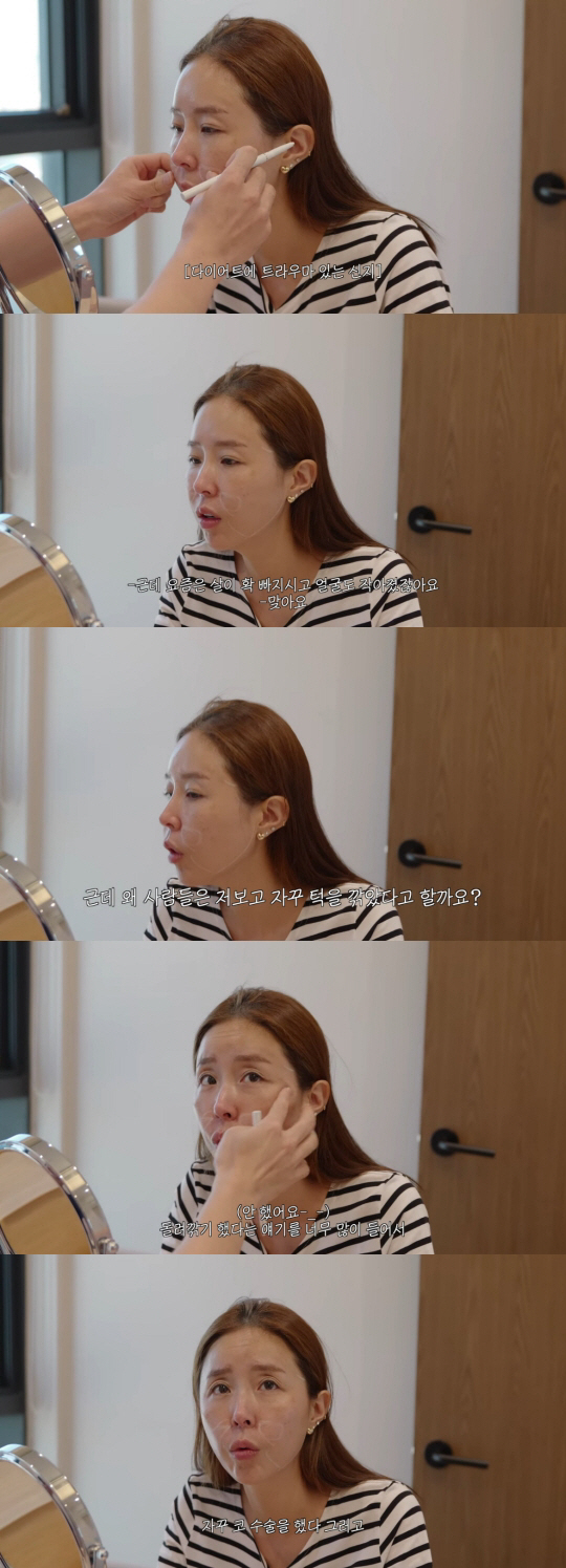 신지, 계속된 성형 의혹 직접 밝혔다 "광대치고 턱 깎고 코 수술까지..…