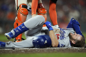 '아찔' 151km 공에 얼굴 맞고 쓰러졌다…그런데 