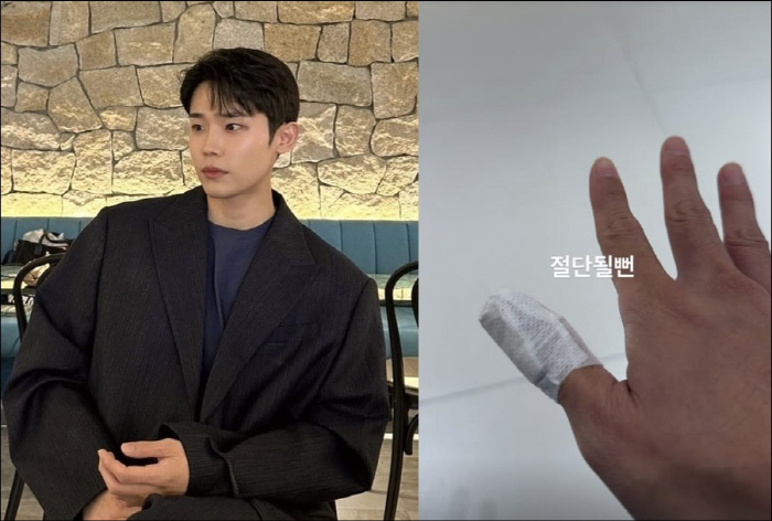 '비행기 사고' 에일리 이어 ♥최시훈도 아찔한 부상 "손가락 절단될 뻔"