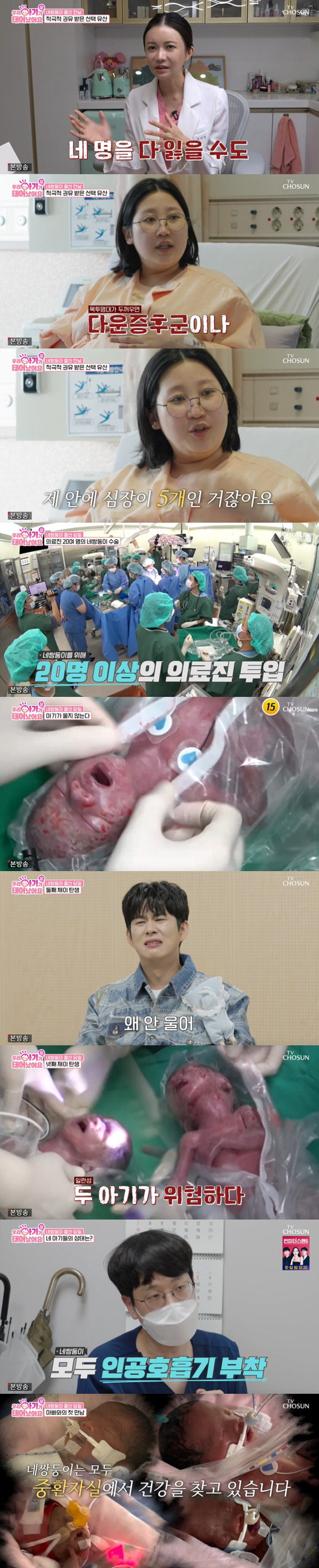 네쌍둥이 출산, 의료진 20명 투입됐지만..4명 다 울음 없이 중환자실行…