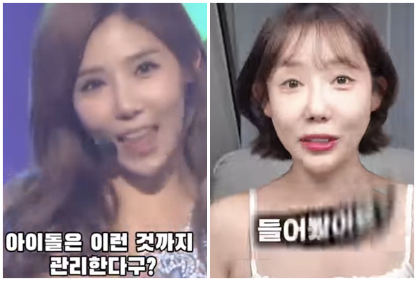 시크릿 징거 맞아?…성형 시술 앱 광고, 15년전보다 더 어려졌네[SC이…