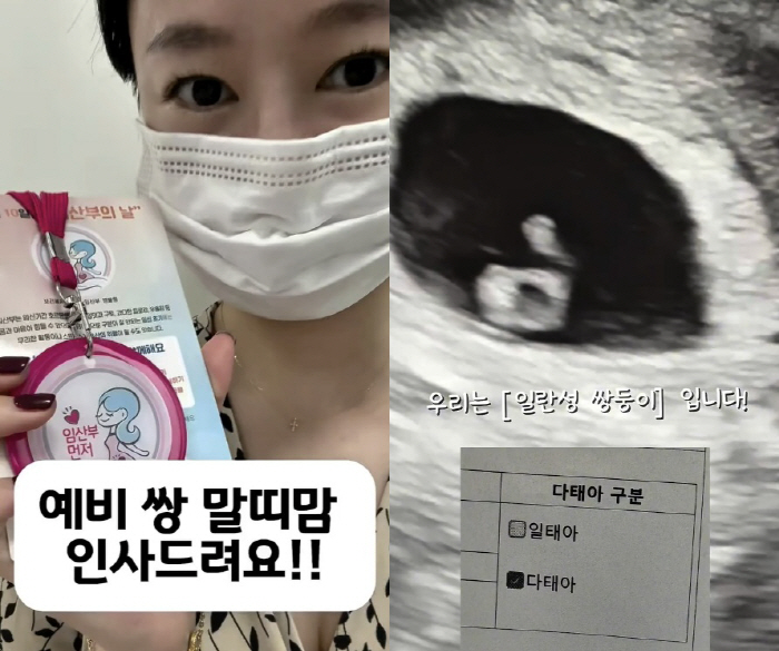40세 오초희, 유산 한달 만에..'0.4% 확률' 일란성 쌍둥이 임신 …
