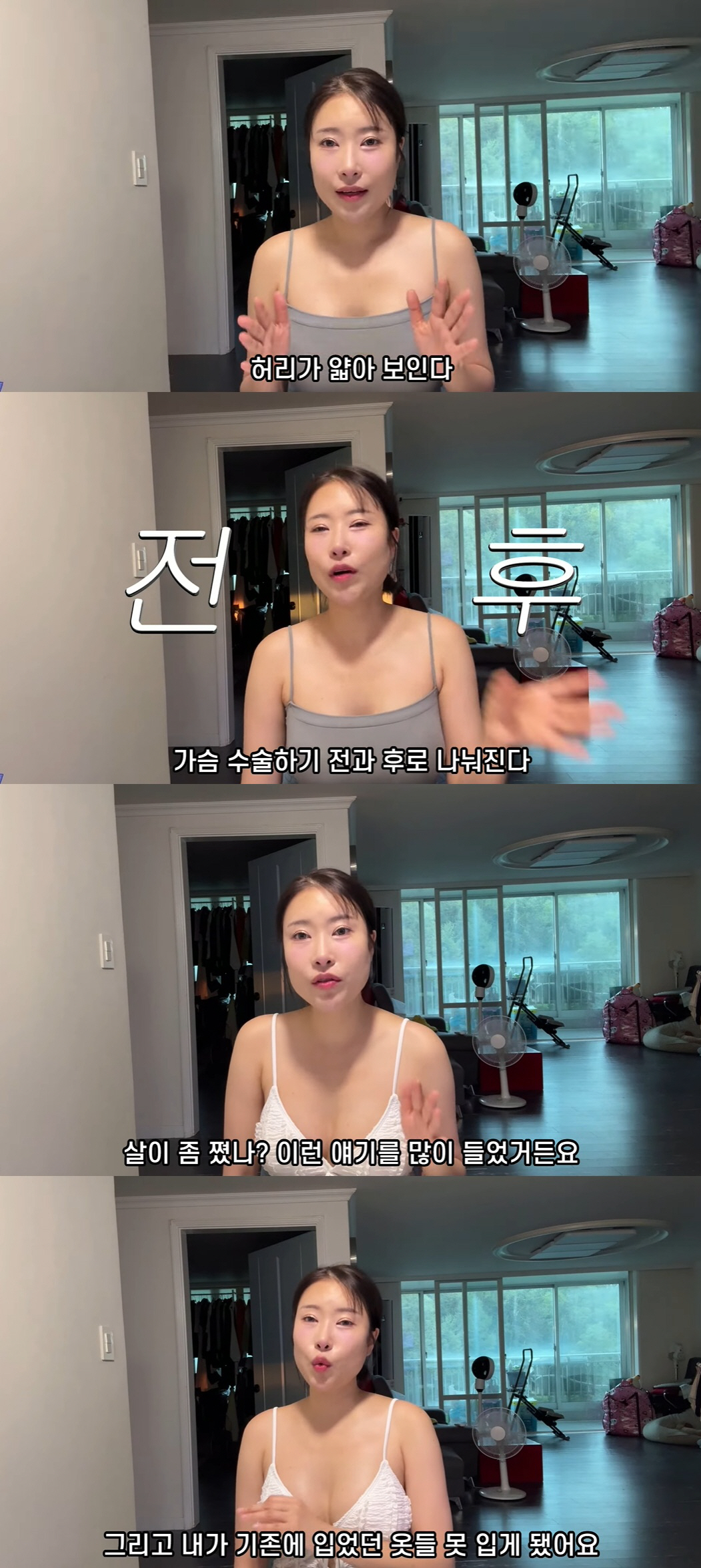 '성형비 1억' 이세영 "A컵→D컵 가슴수술 후 옆으로 못 자, 살쪘다는…