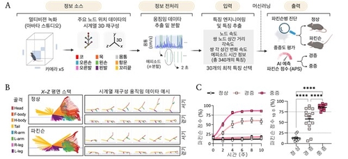 AI로 파킨슨병 조기 진단하고 뇌세포에 빛 쪼여 치료한다