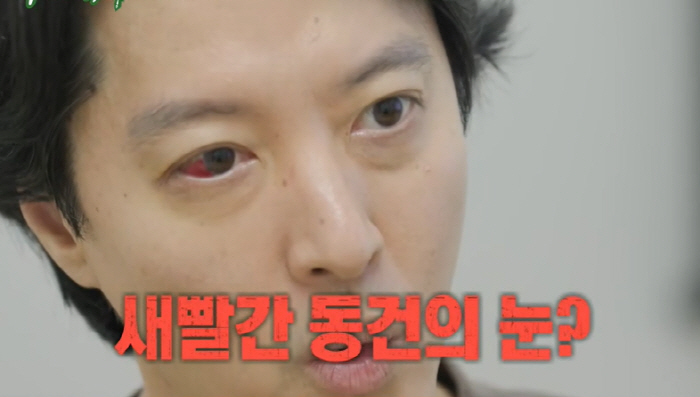 ‘빨간 눈’ 이동건, 1% 희귀병 진단 "송곳으로 찌르는 고통" (미우새…