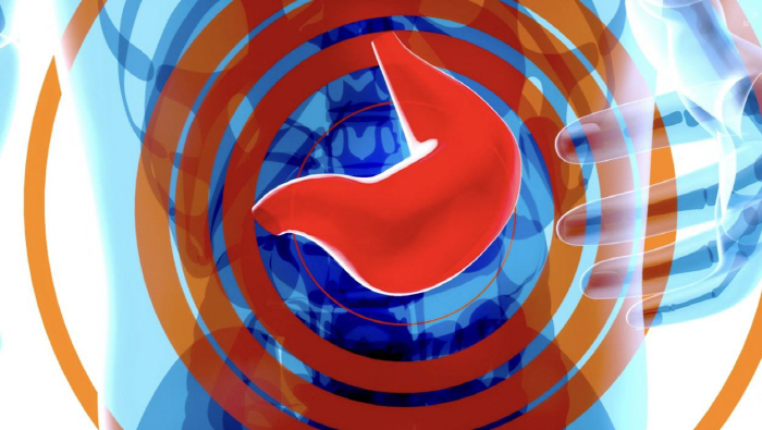 지방간 있는 20·30대, 50세 미만 '젊은 암' 발병 위험 높다