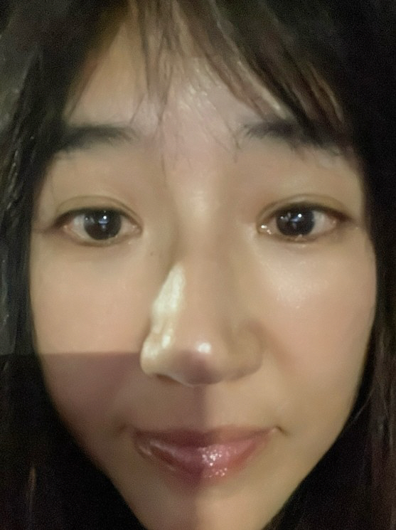 '1형 당뇨' 윤현숙, 또 건강 이상 신호…"CT·피검사 해야 하나"