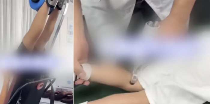 6개월간 아이 키 성장 치료, 10일 만에 원래대로…"사람은 국수가 아냐…