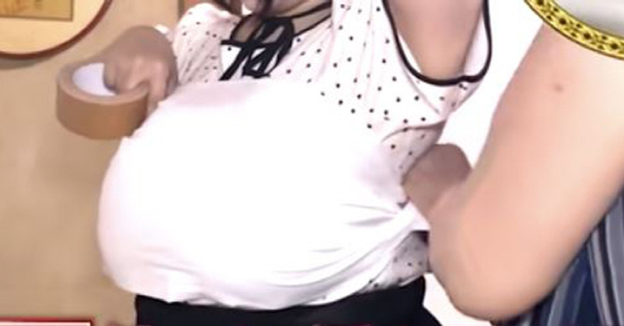 가슴둘레 140cm 여성 "가슴 너무 커서 숨 막혀"…테이프로 감싸기도