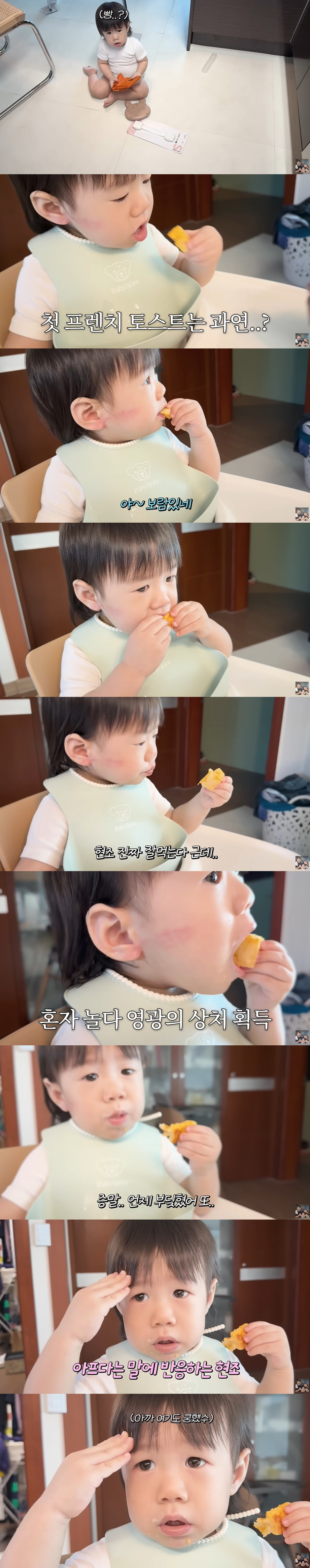 이은형♥강재준, 13개월子 빨갛게 부은 볼 상처에 속상 "혼자 놀다 상처…