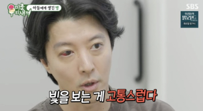 “빛만 봐도 고통, 대한민국 1%만 걸려” 희귀 난치병 공개한 이동건, …