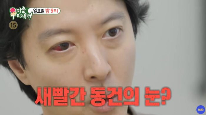 이동건, 새빨간 눈으로 병원行...희귀병인가 "숨만 쉬어도 찌르는 느낌"…