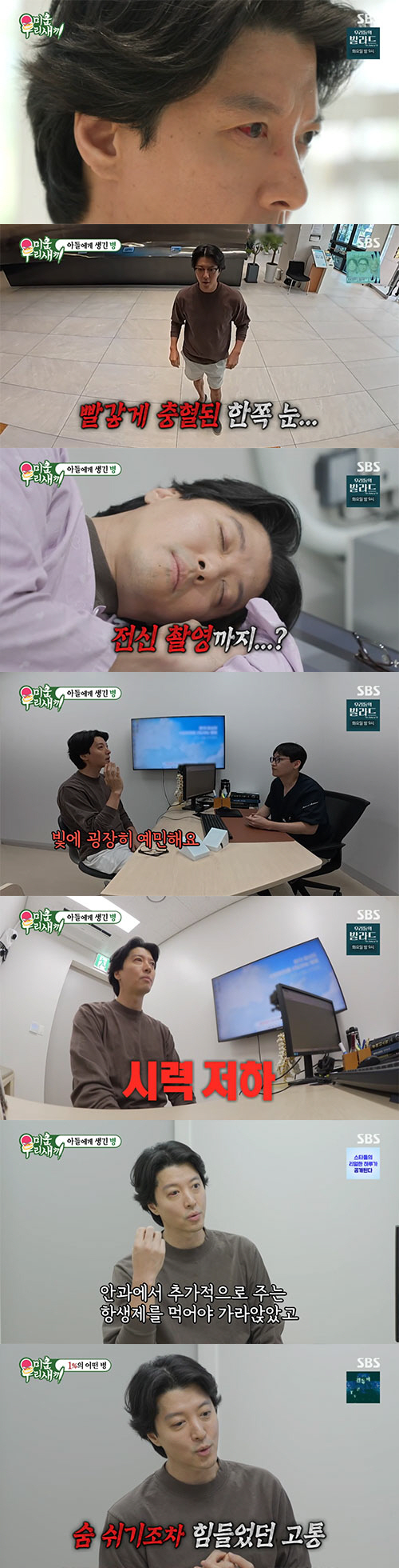 이동건, 1% 희귀 '강직성 척추염' 진단..."원인 불명 완치 불가능"…