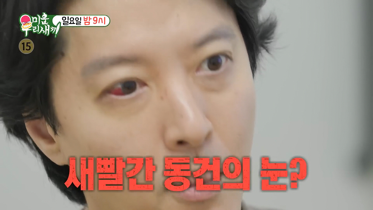 이동건, 한국인 1%만 발병 희귀질환 진단에 '충격'…"송곳으로 찌르는듯…