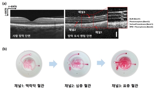 망막 질환 검사 정확도 높일 '인공 눈' 개발