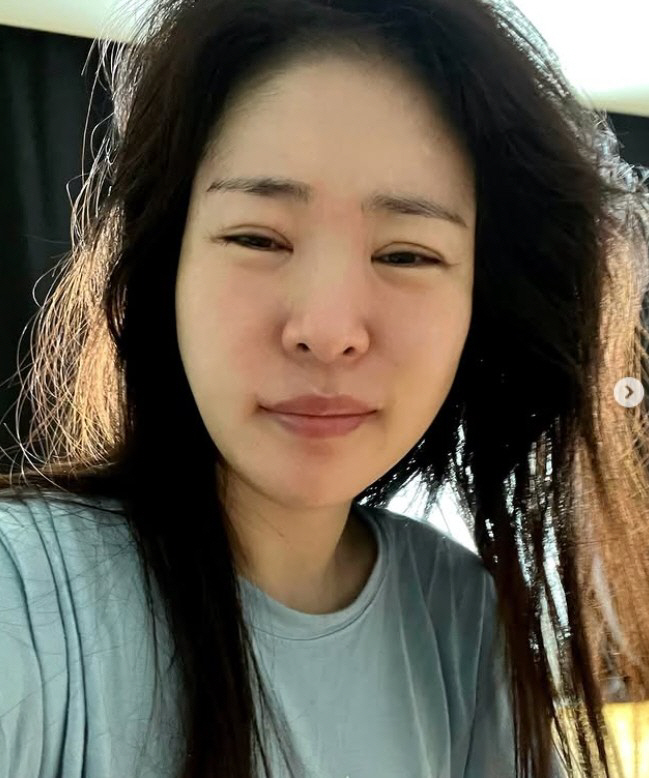 '김태현♥' 미자, 얼굴에 숙취 제대로 맞았다..."술은 사랑, 숙취는 …