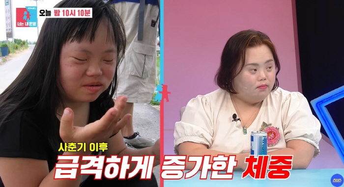 '다운증후군' 정은혜, "살쪘다"고 쏟아진 악플들..."병 때문인데" 엄…