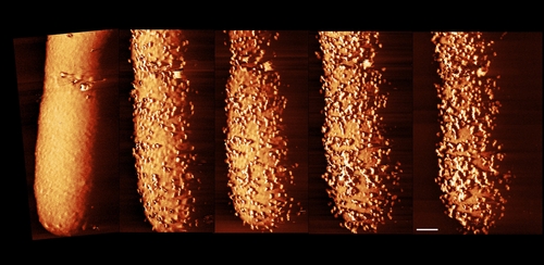 [사이테크+] "항생제가 박테리아 방어막 뚫고 침투하는 장면 첫 포착"