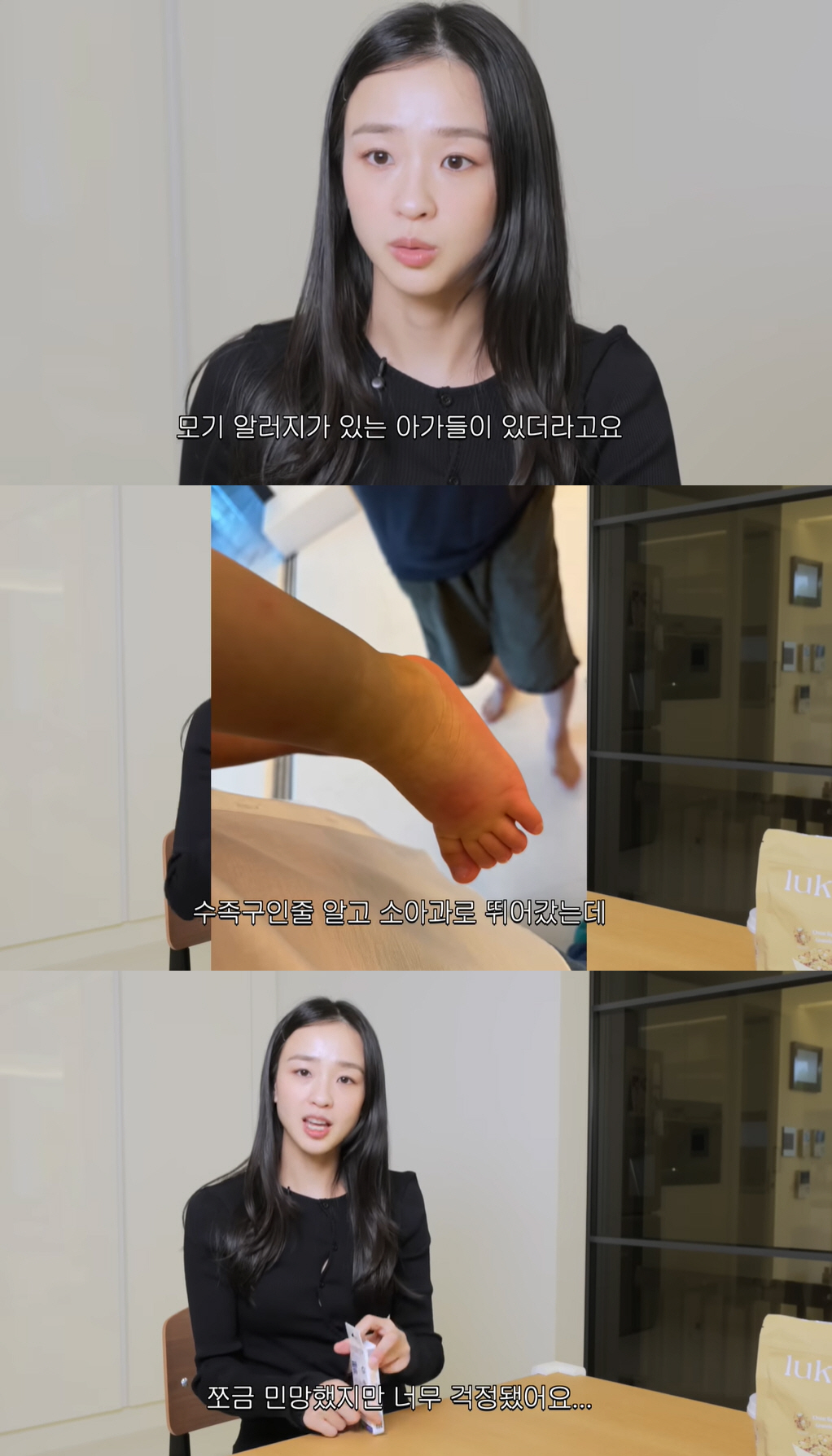 손연재, “얼굴 20방 물려 염증과 고름이”..子 모기 알러지에 ‘가슴 …