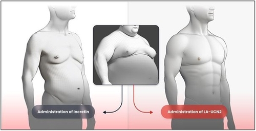 한미약품, 비만약 'HM17321' 미국 임상 1상 계획 신청