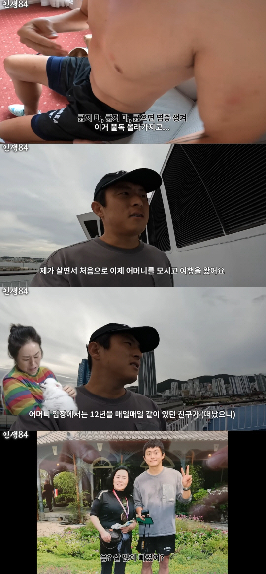 기안84, 박나래 돕다가 풀독 심각..등까지 번져 "벌레에 쏘인 듯"