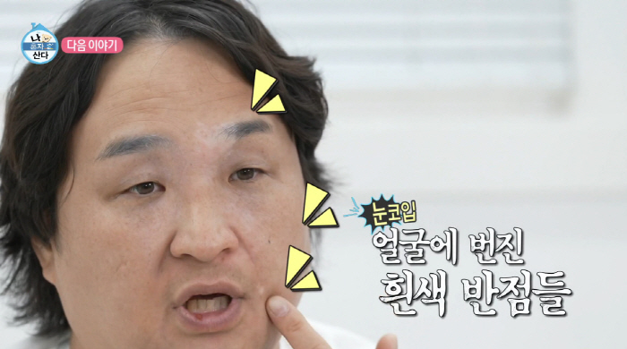 구성환, 난치병 치료 받다 눈물..."완치 불가. 낫는다는 보장 없다"