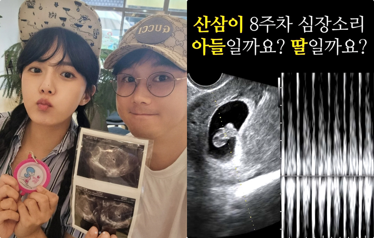 '40세 자연임신' 강은비,  첫 심장 소리에 울컥 "작고 소중, 두근거…