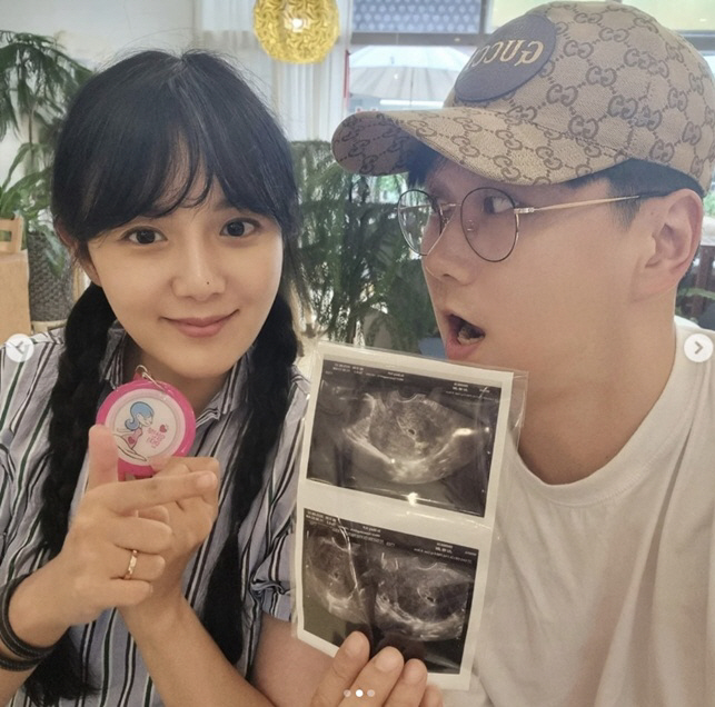 '40세 자연임신' 강은비,  첫 심장 소리에 울컥 "작고 소중, 두근거…