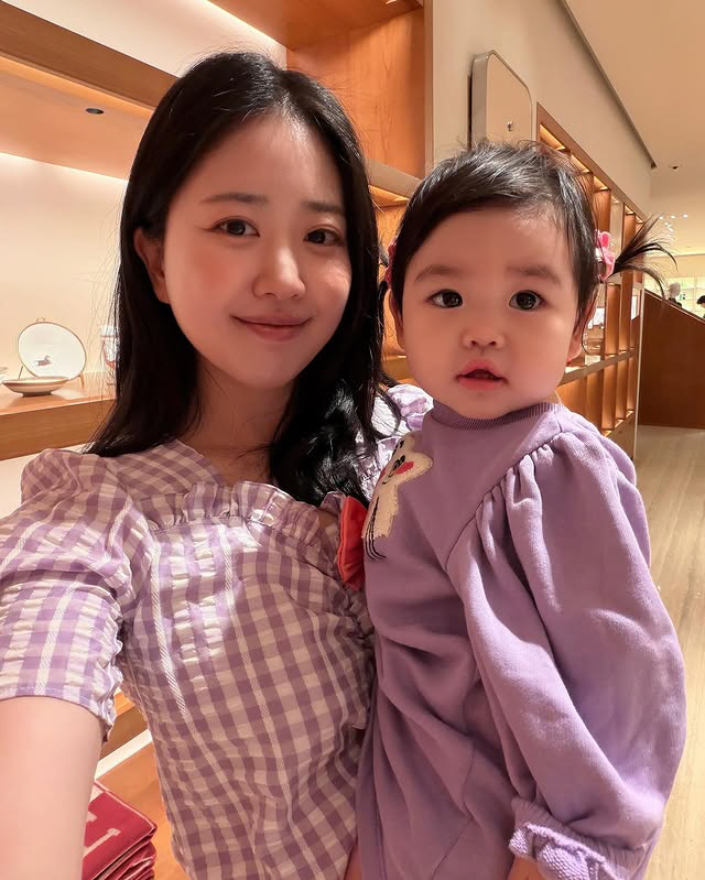 '박수홍♥' 김다예, 쌍꺼풀 주름 고민 고백 "1줄이 9줄로, 할머니 되…