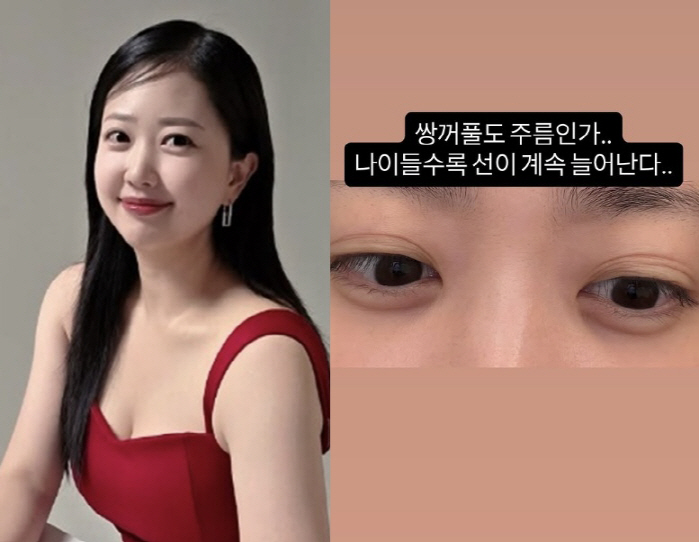 '박수홍♥' 김다예, 30kg 빼고 '늘어난 주름'에 충격 "1줄이 9줄…