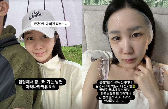 '암치료 후 임신' 초아, 안타까운 소식 전했다..."울렁거림 유독 심하…