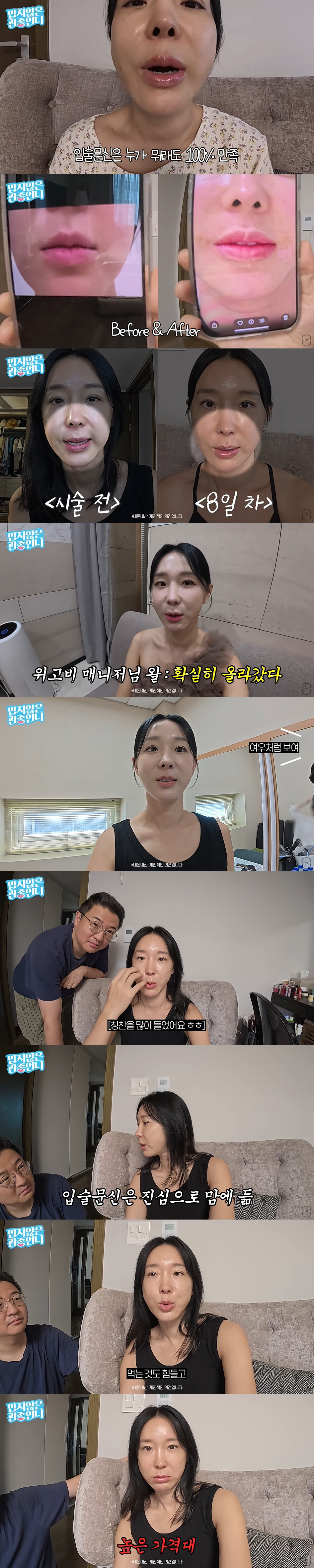 '46세' 이지혜, 실리프팅+입술 문신 고백 "노화 뚜렷해져서 시술 결정…