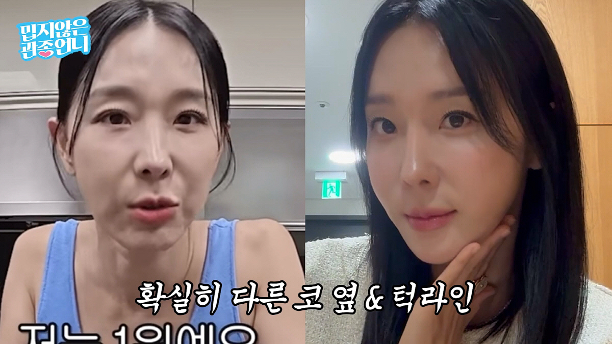 '46세' 이지혜 얼굴 성형 비포&애프터 공개…"노화 느꼈었는데 확 달라…