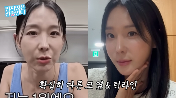 '45세' 이지혜, 실리프팅 후 얼굴 확 달라졌다...♥문재완 "진짜 예…
