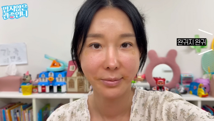 이지혜, 입술 문신 후 '헤르페스' 걸렸다...초췌해진 얼굴에도 "결과는 만족"