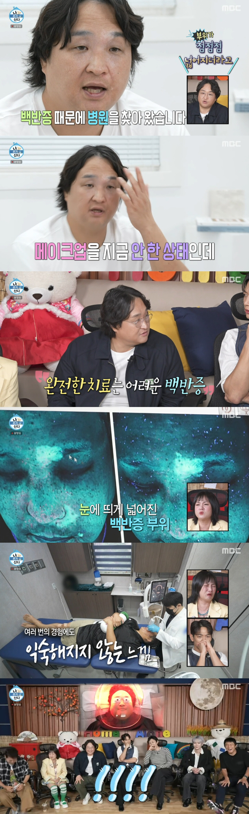 구성환, 백반증 부위 점점 넓어져 심각.."털이 다 하얗게 돼" ('나혼…