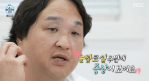 구성환, 난치성 질환 '백반증' 심각한 피부 상태...