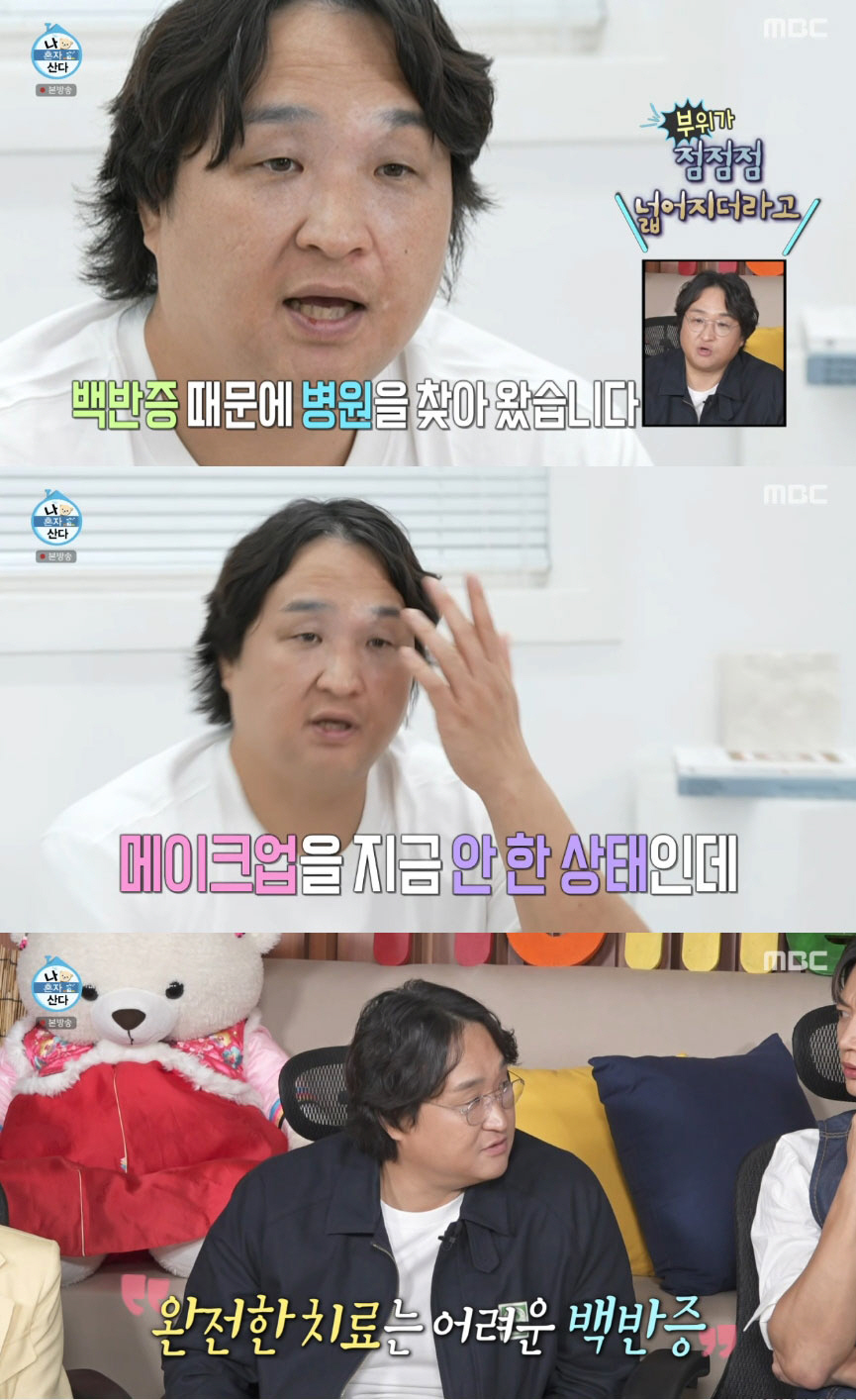 구성환, 난치성 질환 '백반증' 심각한 피부 상태..."살찐 만큼 번져"