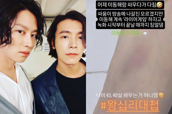 “싸우다 다쳐” 김희철·이동해, 실제 몸싸움했나..선명하게 올라온 붉은 …