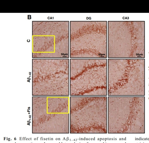 '대통령 표창' 받은 알츠하이머 학자, 논문 5편 철회