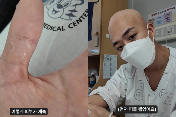 '선미 댄서 출신' 차현승, 백혈병 투병 근황 “피부 벗겨지고 수치 안 …
