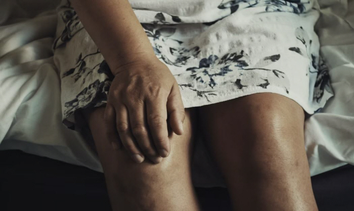 "살 빼야 하는 이유 또 있네"…비만인 무릎 관절염 유병률 1.8배 높아