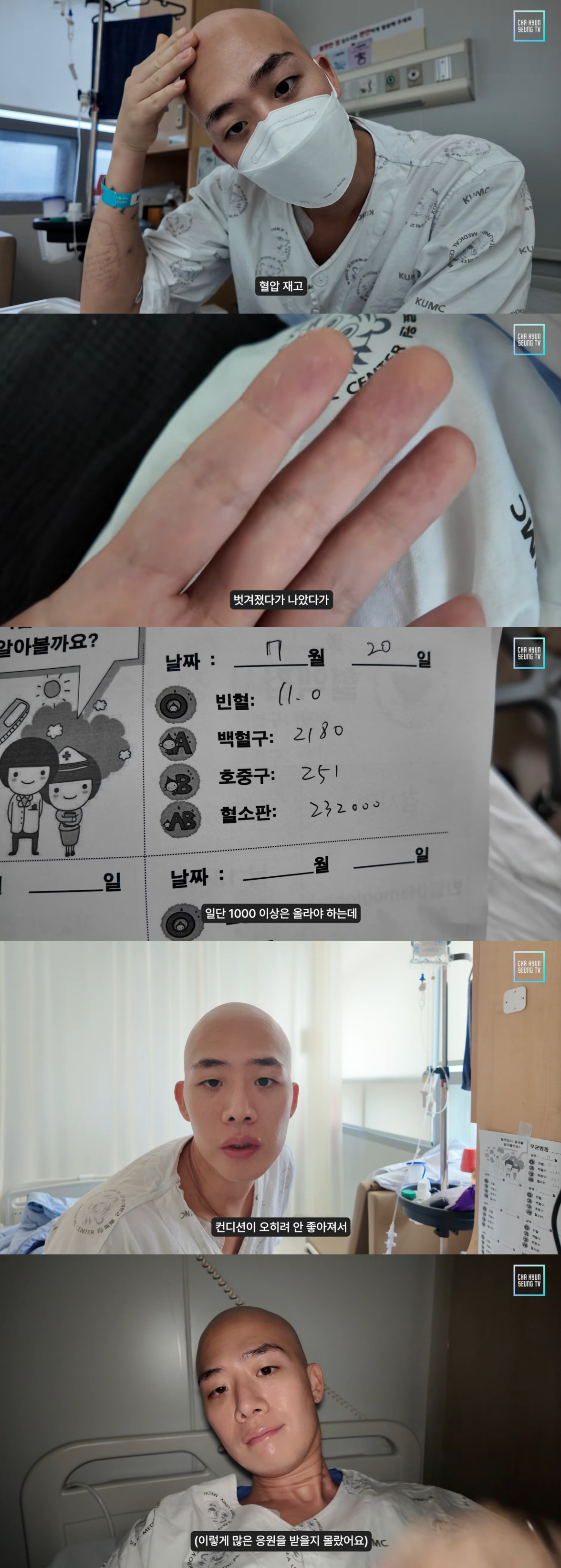 '백혈병 투병' 차현승 "피부 벗겨짐 반복..수치도 올라야 하는데 안 잡…