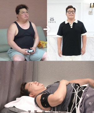 '105kg' 윤정수, 지방흡입 부작용 고백하더니 