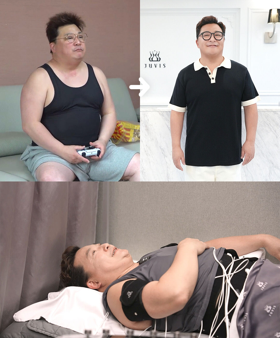 '105kg' 윤정수, 지방흡입 부작용 고백하더니 "89kg까지 감량, …