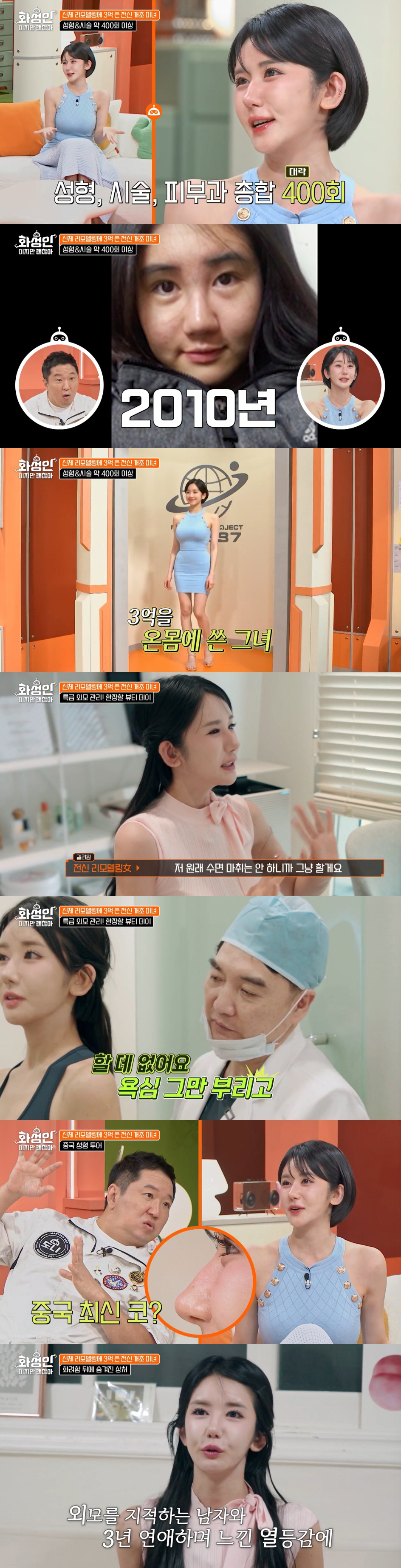 길리원, 성형·시술 400회.."전신 리모델링에 3억, 후회 없어" ('…