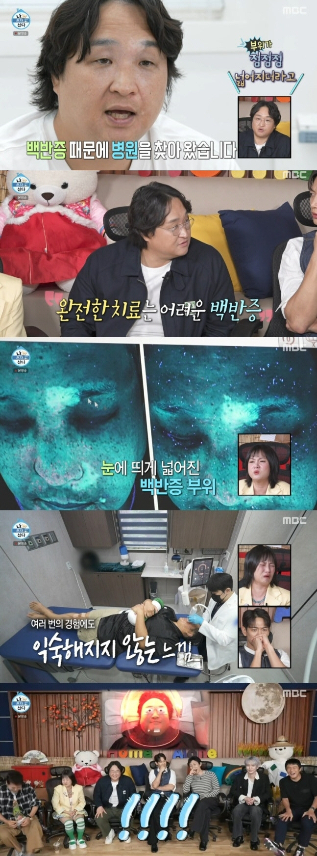 구성환 '백반증 시술' 성형외과 사과 "일부 편집..피부과 전문의 영역 …