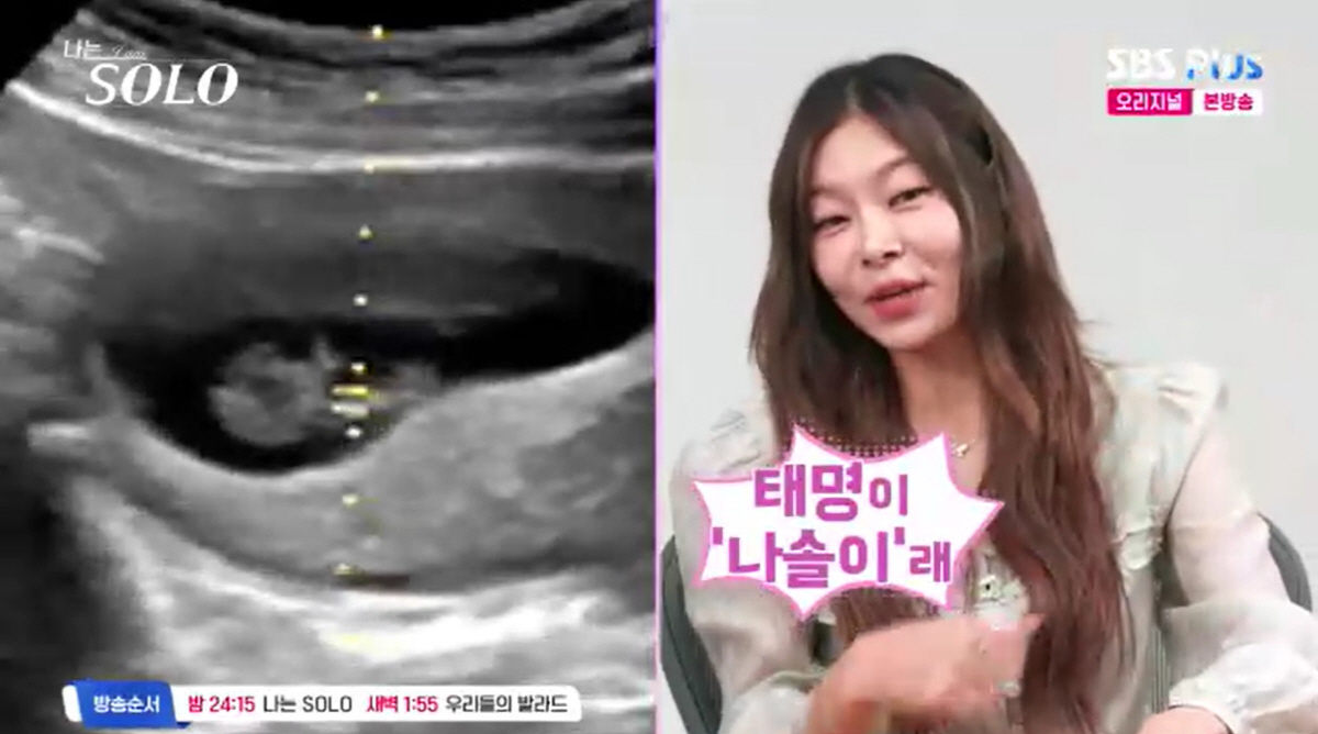 '나솔' 돌싱 28기, 혼전임신 커플 탄생했다.."심장박동은 처음, 태명…