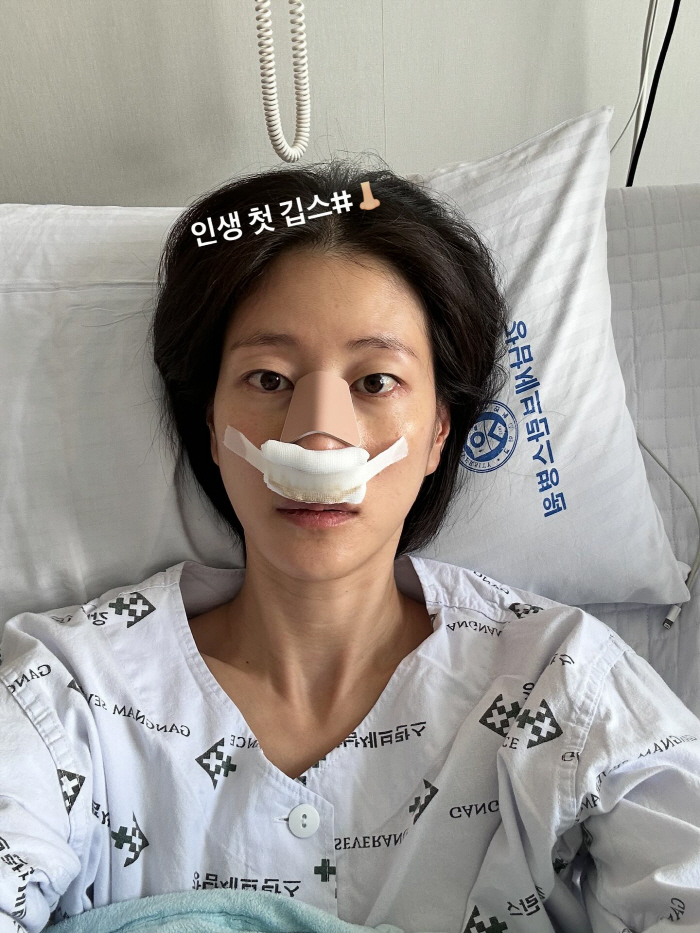 이현이, '코 수술' 실시간 공개…"예전 코로 돌아왔다"[SCin스타]